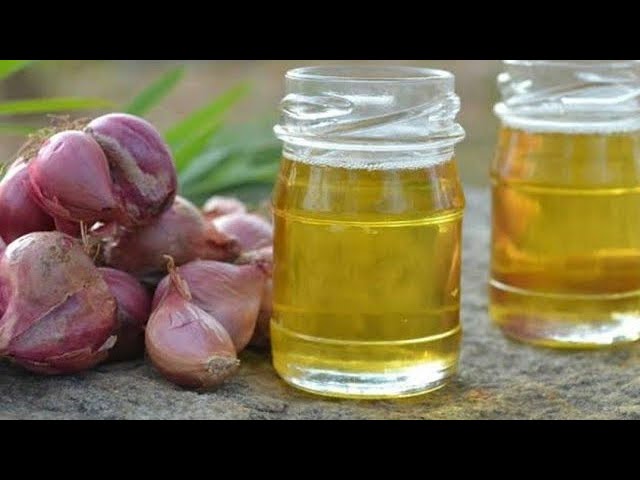 Onion Oil for Dandruff